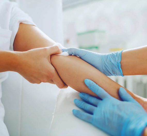 Šta je i kako se radi OGTT test?