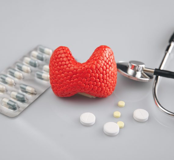 Hašimoto sindrom – šta je, koji su simptomi i kako se leči?